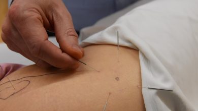 A New York City man has been charged with performing acupuncture without a license after injuring a woman