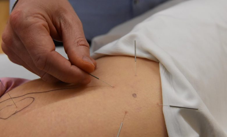 A New York City man has been charged with performing acupuncture without a license after injuring a woman